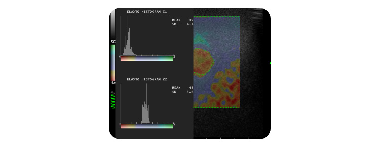 histogram