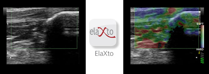 elaxto