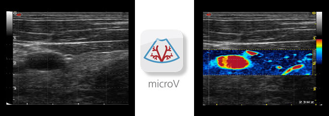 microv