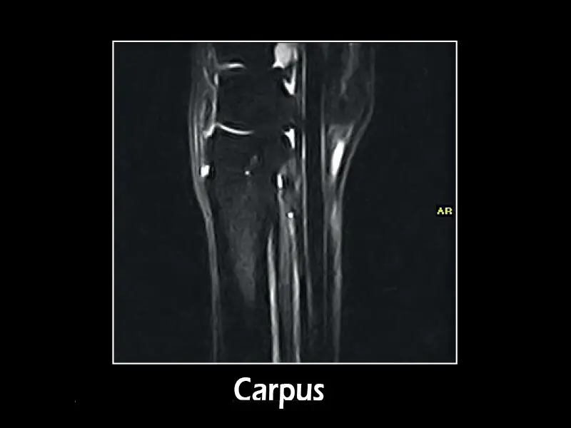 G-scan equine: Carpus