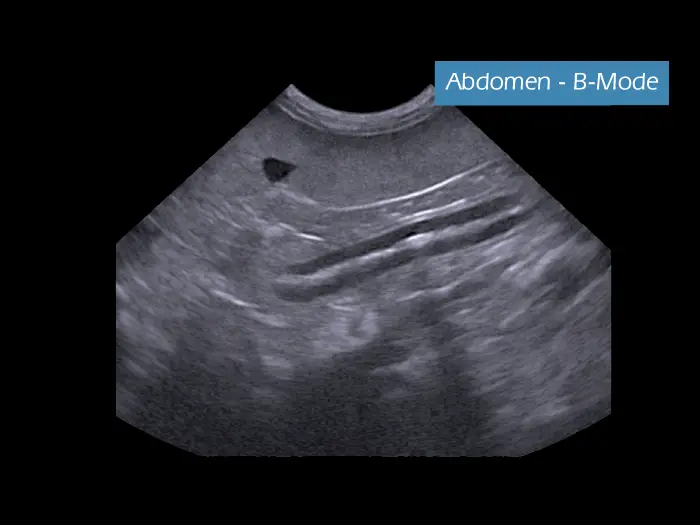 Klinik Görüntü - MyLab ™ AlphaVET Abdomen - B-Modu