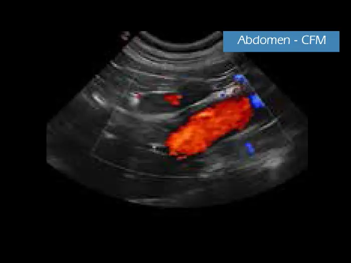 Klinik Görüntü - MyLab ™ DeltaVET - Abdomen CFM