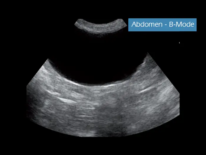 Klinik Görüntü - MyLab ™ GammaVET - Abdomen B-Modu