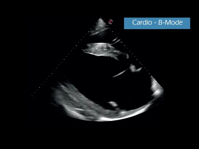 Klinik Görüntü - MyLab ™ GammaVET - Kardiyo B-Modu