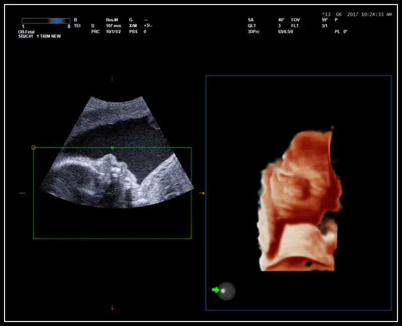 MyLab ™ 9 Platformu - 4D görüntüleme ile gerçek zamanlı bebek yüzü