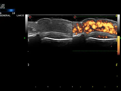 MyLab ™ ClassC - HD Power Doppler Görüntüleme