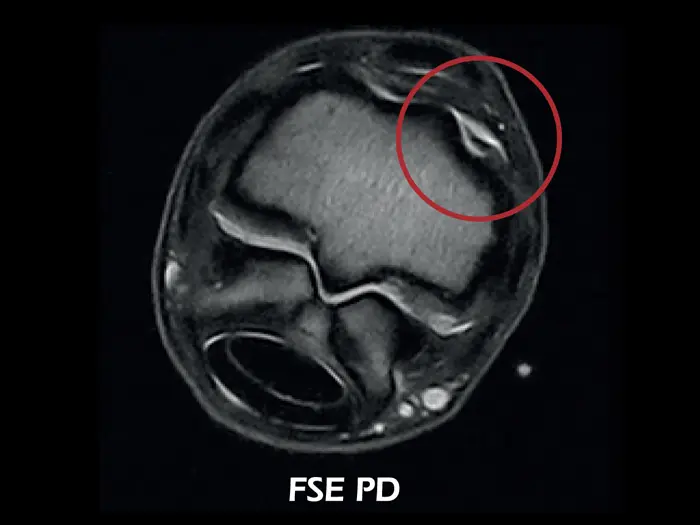O-scan equine: Fetlock Artropati